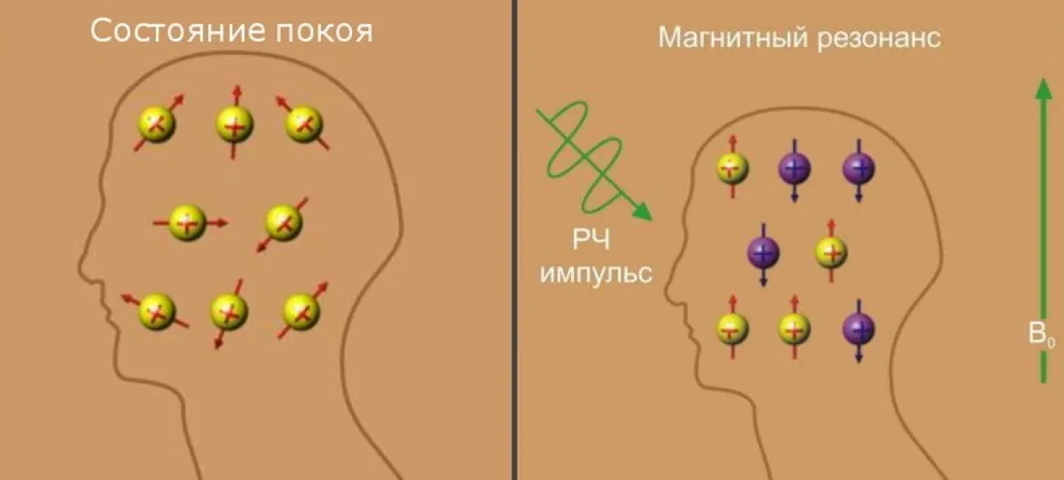 Схема воздействия РЧ-импульса и возврата протонов к равновесию
