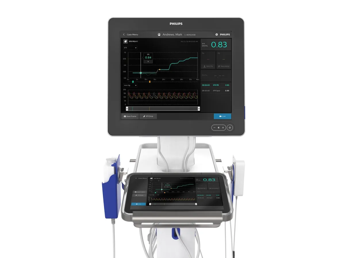 ВСУЗИ аппарат Philips IntraSight