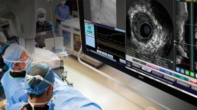Аппарат для ВСУЗИ Philips Volcano Core