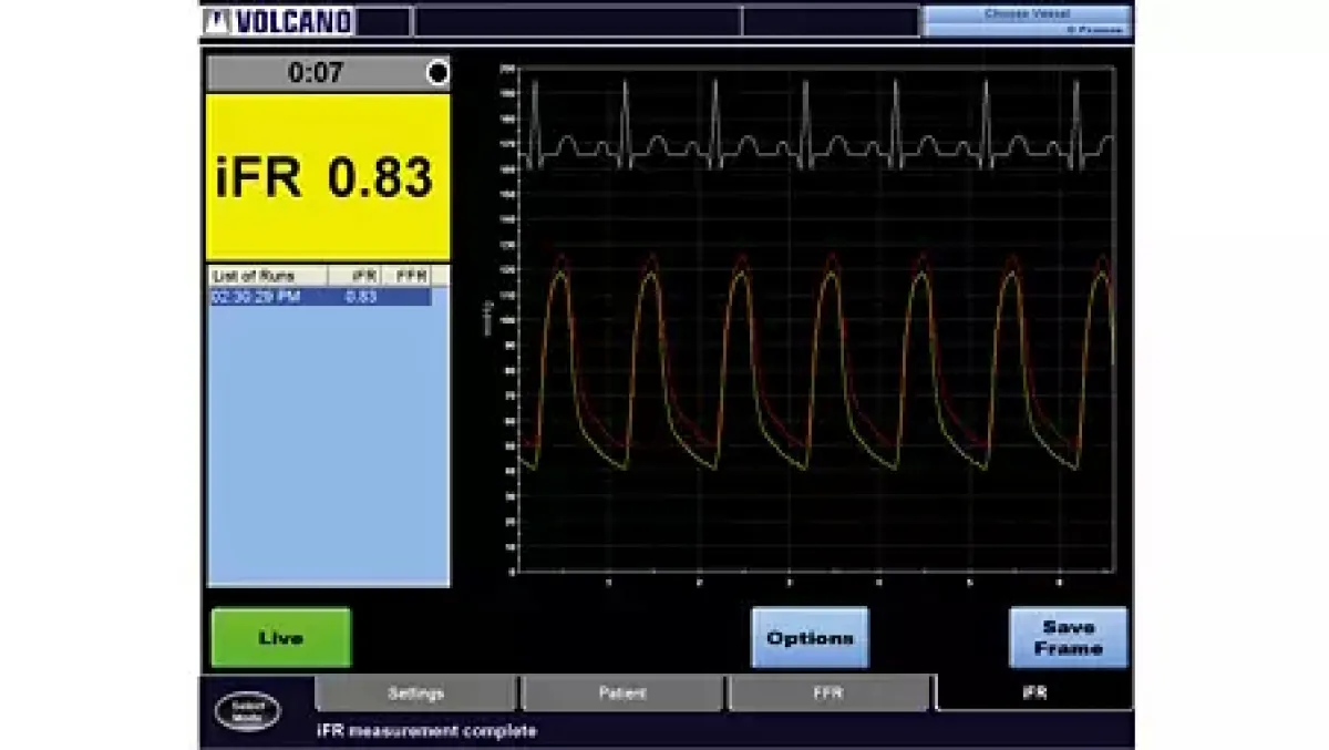 Philips Volcano Core метод iFR 