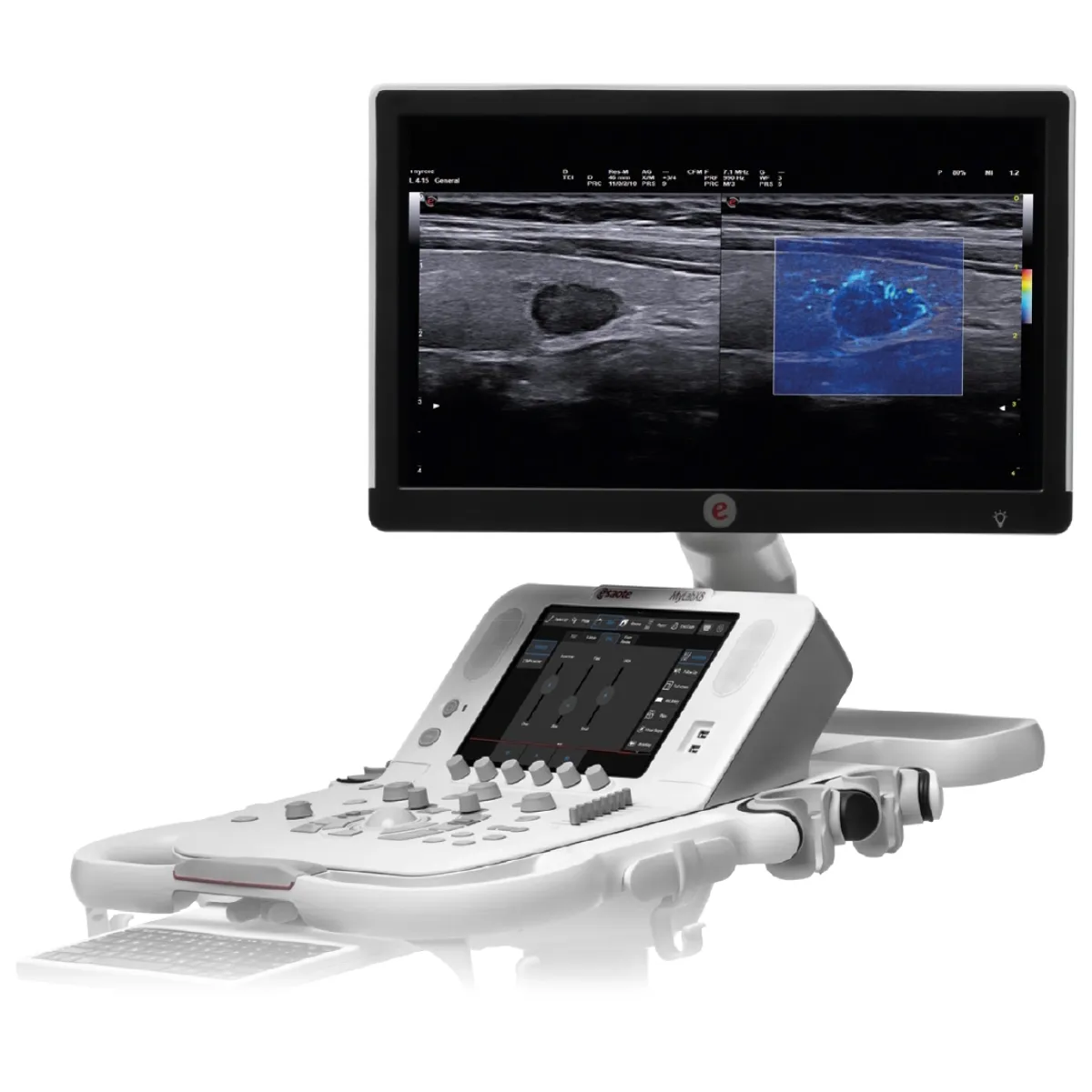 УЗИ аппарат Esaote MyLab X8 eXP