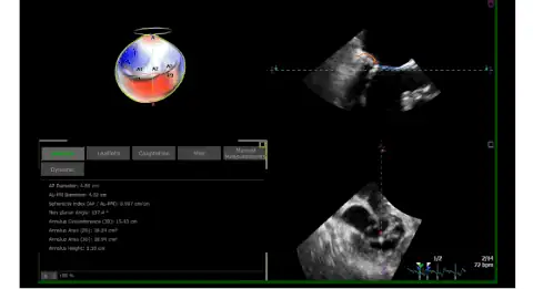 Fujifilm Lisendo 880 технология 4D MV Assessment
