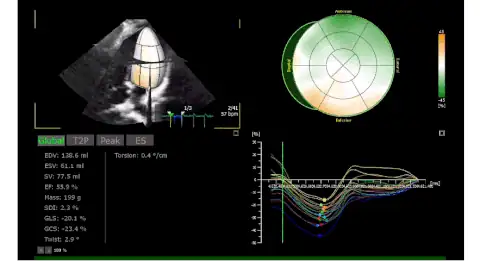 Fujifilm Lisendo 880 технология 4D LV-ANALYSIS