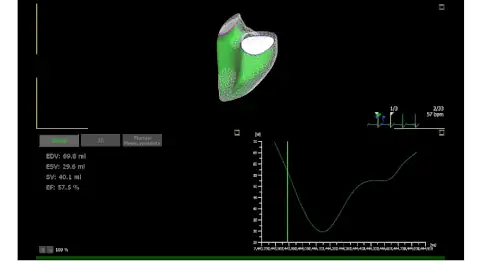 Fujifilm Lisendo 880 технология 4D LV-ANALYSIS