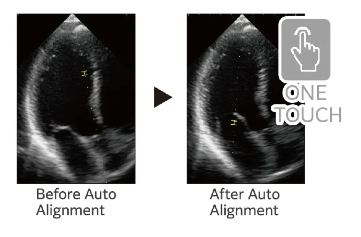 Automated Sample Gate Alignment