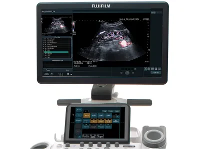 Аппарат УЗИ Fujifilm Arietta 65