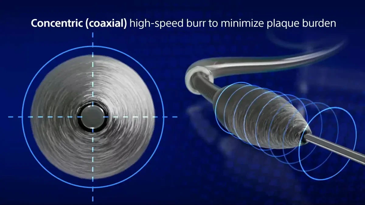 Конструкция бура системы Boston Scientific ROTAPRO 