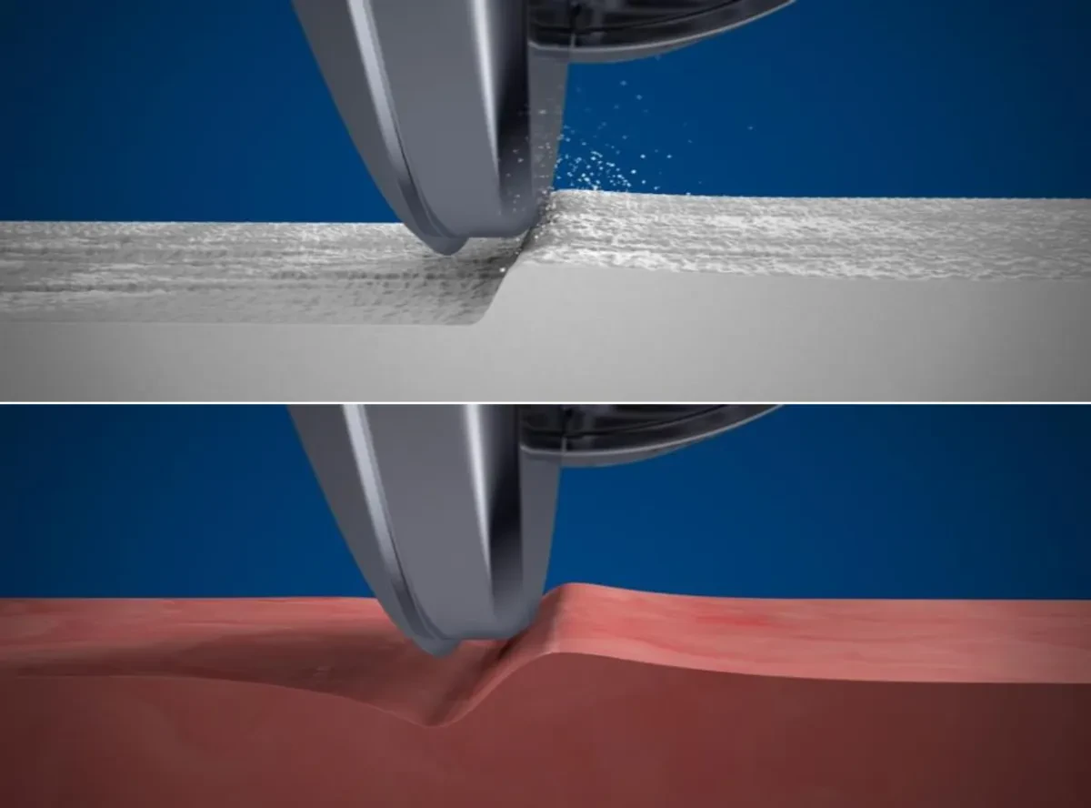 Технология дифференцированного рассечения тканей в Boston Scientific JETSTREAM
