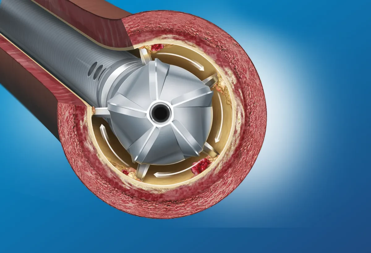 Ротационные лезвия Boston Scientific JETSTREAM