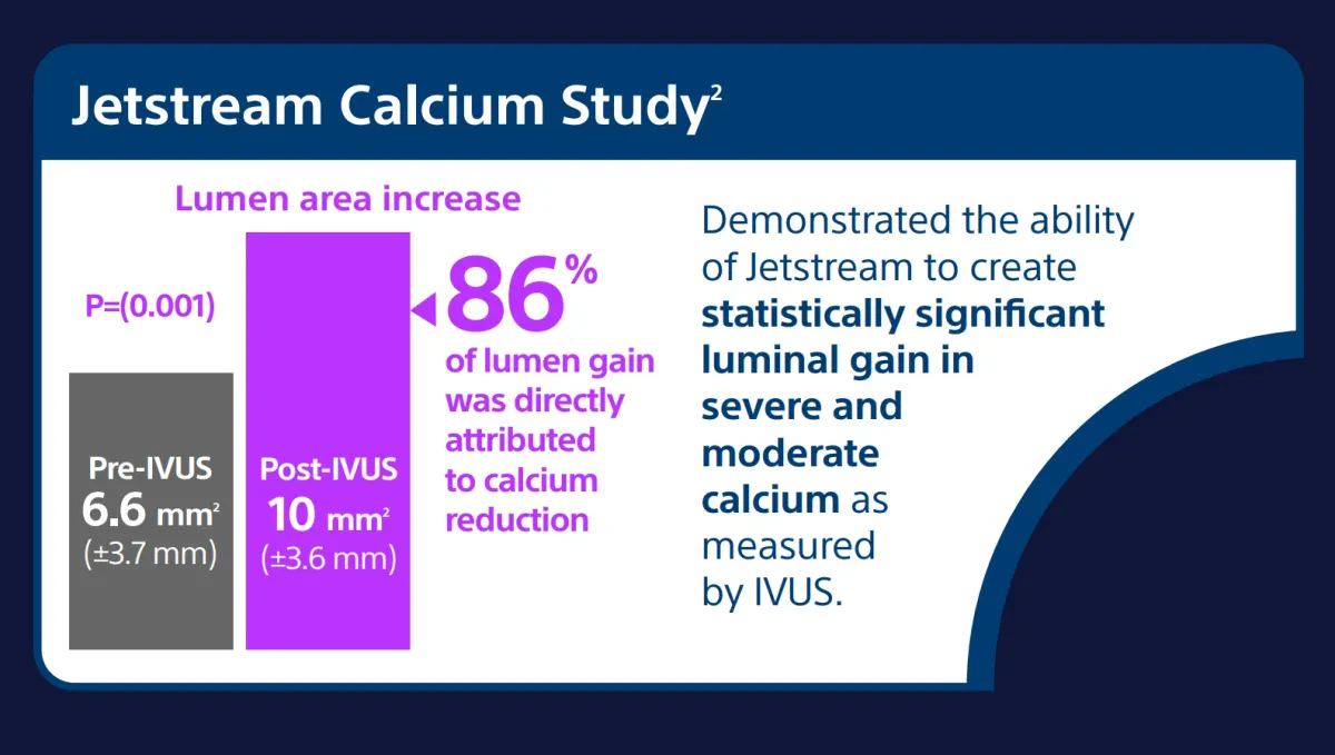 Результаты исследования Jetstream Calcium Study — эффективность удаления кальция под контролем ВСУЗИ