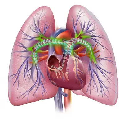 Система ультразвуковой тромбэктомии Boston Scientific EKOS