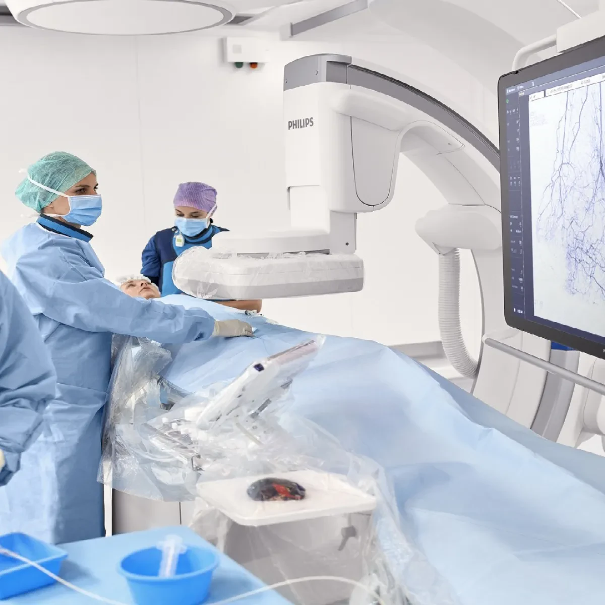 эксимерная лазерная система Philips Spectranetics CVX-300-Р