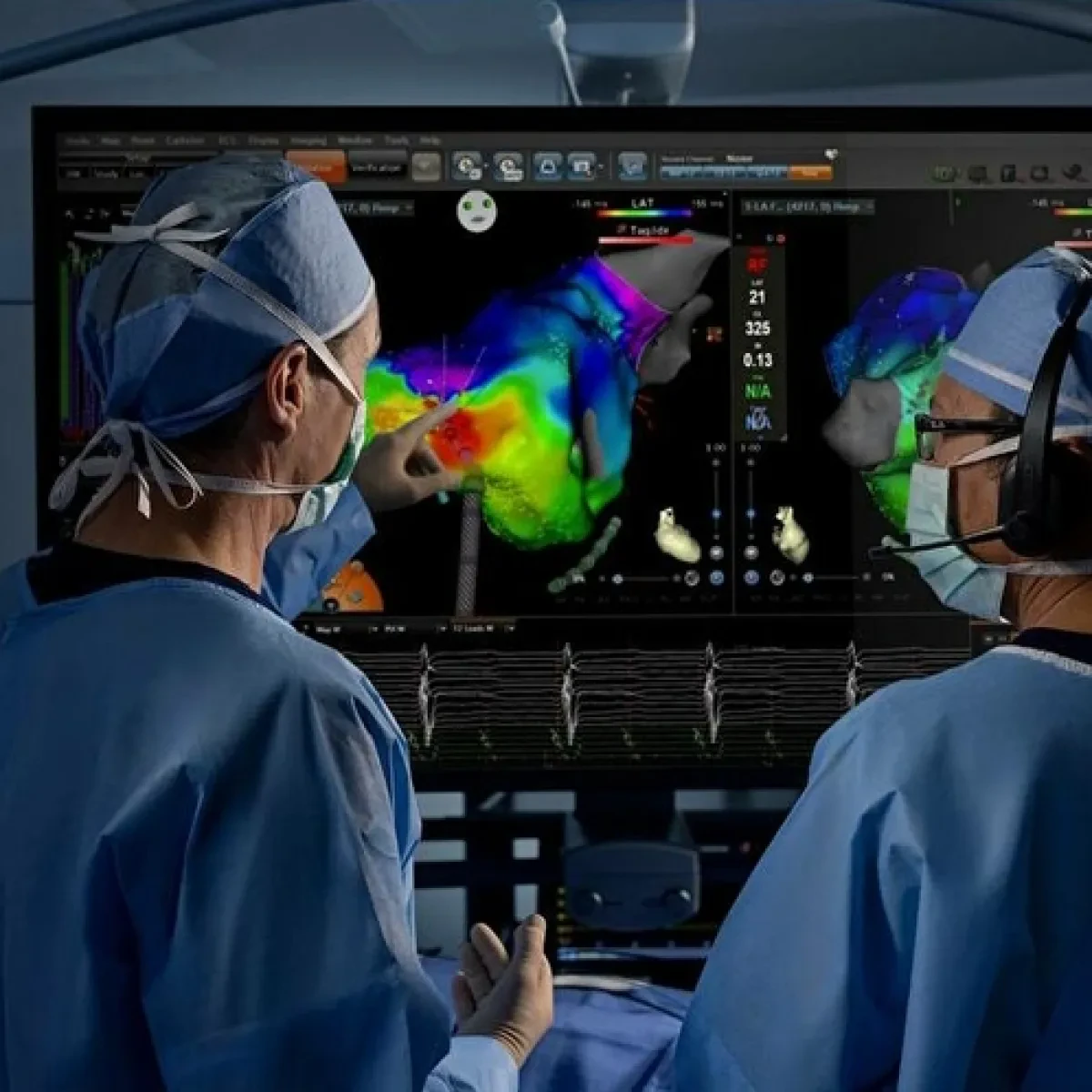 Biosense Webster CARTO 3