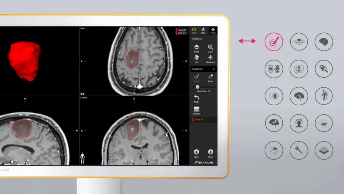 Интраоперационное планирование в Brainlab Curve