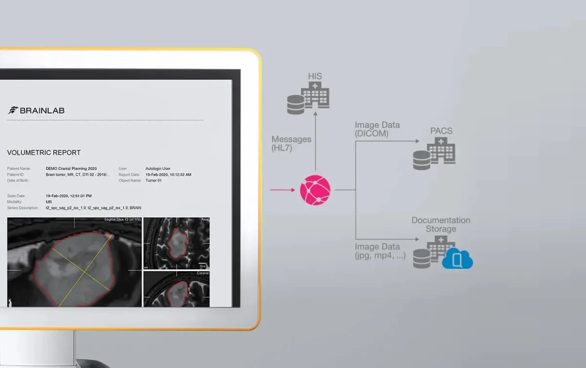 Централизованное управление данными в нейронавигации Brainlab Curve