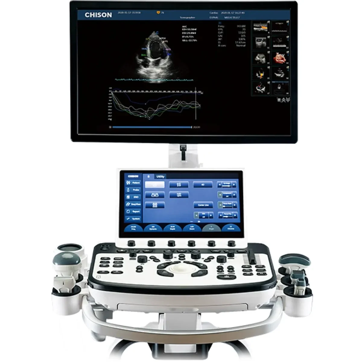 Chison Xbit 80