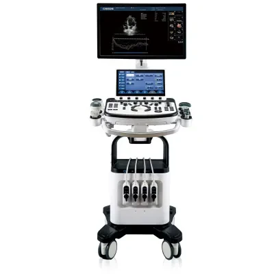Chison Xbit 80