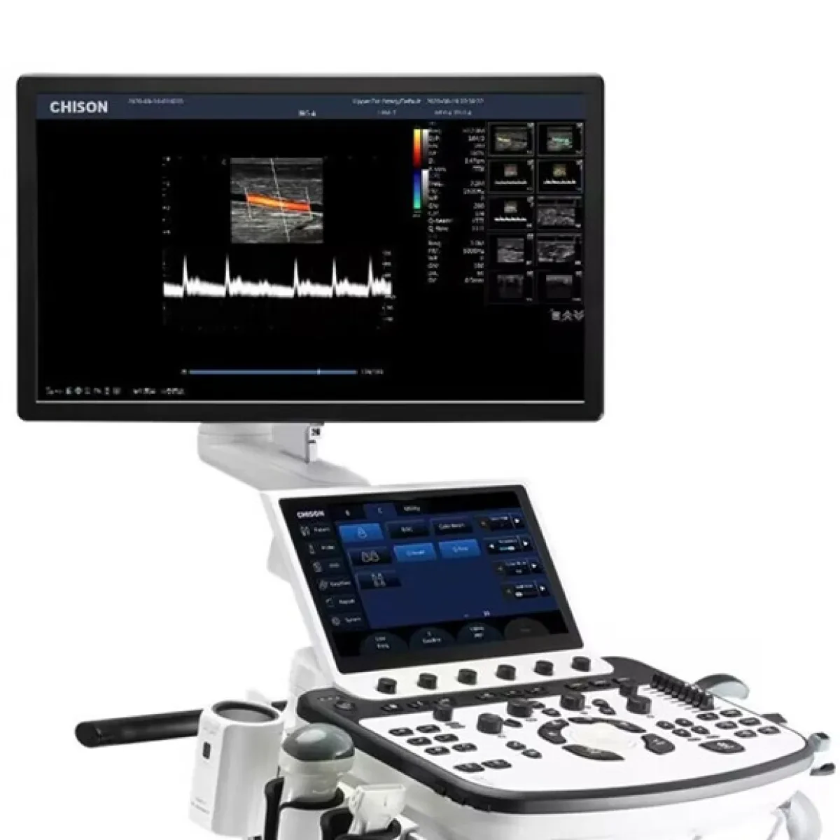 Chison Xbit 80