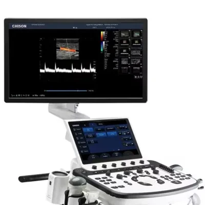 Chison Xbit 80