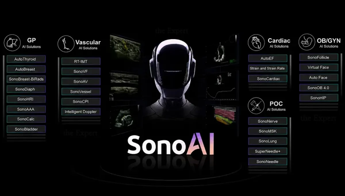 SonoAI для интеллектуальной поддержки ультразвуковой диагностики