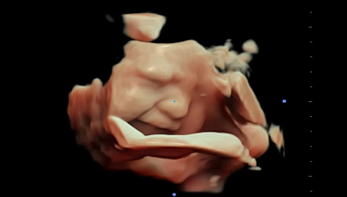 Технология 4D Virtual+ для объёмной визуализации