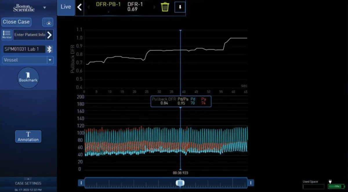 Технология PhysioMap